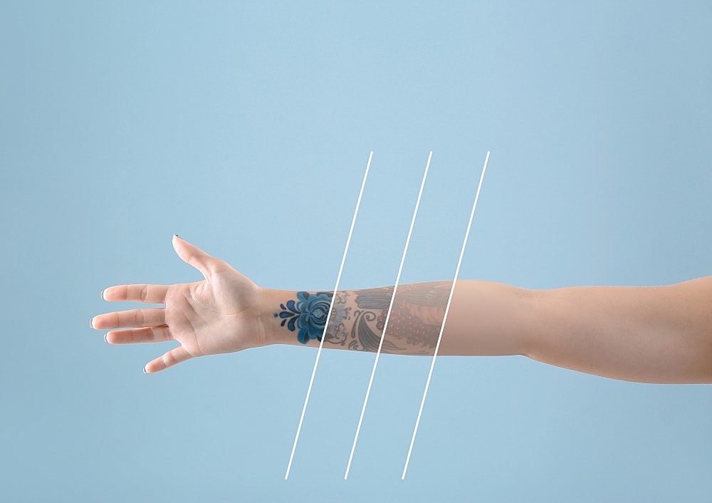 Tattoo Removal: How Long Does it Take?