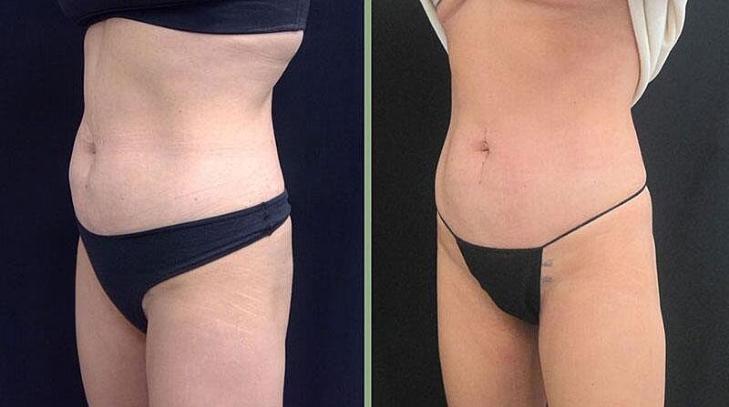 Weight Management Before & After Image